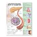 Understanding Type 2 Diabetes Anatomical Chart