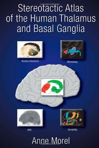 Stereotactic Atlas of the Human Thalamus and Basal Ganglia On Sale