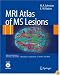 MRI Atlas of MS Lesions
