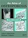 Book Atlas of Osteoporosis, Third Edition (Encyclopedia of Visual Medicine)
