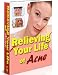 Relieving Your Life Of Acne: Secrets You Need Now.