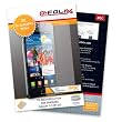 atFoliX FX-Antireflex Displayschutzfolie f�r Samsung Galaxy S2 i9100 (3 St�ck)