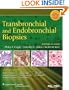 Transbronchial and Endobronchial Biopsies