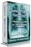 Basics of Chest Radiology