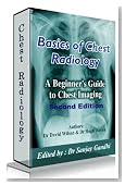 Basics of Chest Radiology