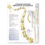 Understanding Multiple Sclerosis Anat...