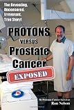 PROTONS versus Prostate Cancer: EXPOSED: Learn what proton beam therapy for prostate cancer is really like from the patient's point of view in complete, uncensored detail.