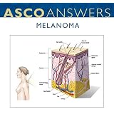 Melanoma Cancer Fact Sheet (pack of 125 fact sheets)