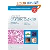 Advances in Surgical Pathology: Gastric Cancer