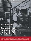 Acres of Skin