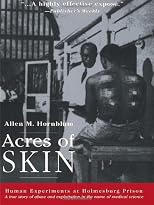 Acres of Skin