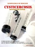 Cysticercosis : Question and Answers,Teania Infection (Knowledge of Disease)