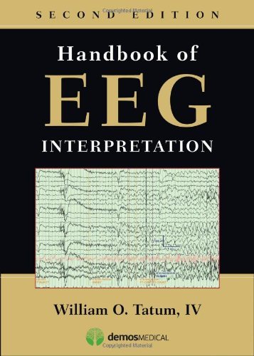 Handbook of EEG Interpretation, 2nd Ed (2nd Second Edition) [Paperback]