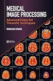 Medical image processing : advanced fuzzy set theoretic techniques
