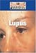 Book Lupus (Diseases and Disorders)