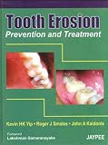 Tooth Erosion Prevention and Treatment