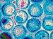 Virology Electron Micrograph Herpes Simplex Viruses Acute Eruption Blisters Photographic Poster Print, 16x12