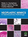 Neoplastic mimics in genitourinary pathology
