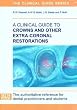 A Clinical Guide to Crowns and Other Extra-coronal Restorations