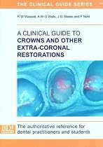 Clinical Guide to Crowns and Other Extra-Coronal Restorations
