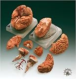 Brain With Arteries Model
