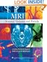 MRI Normal Variants and Pitfalls