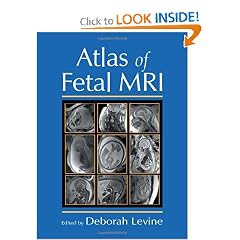 Atlas of Fetal MRI by Deborah Levine