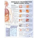 Sexually Transmitted Infections Anatomical Chart Laminated