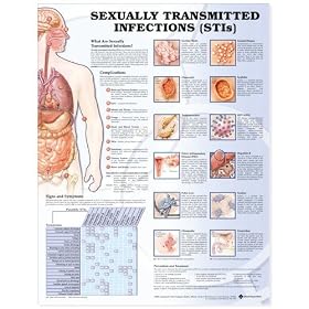 Sexually Transmitted Infections Chart STI