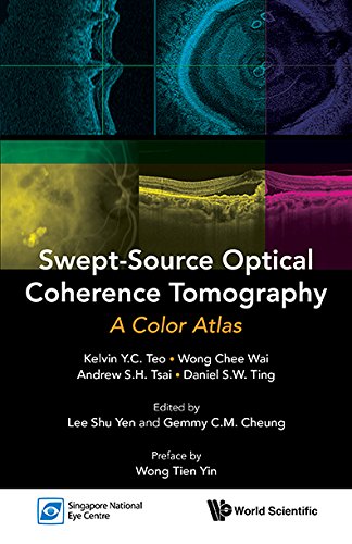Swept-Source Optical Coherence Tomography:A Color Atlas