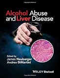 Alcohol abuse and liver disease