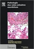 Pathologie des voies urinaires excrétrices