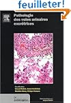 Pathologie des voies urinaires excr�t...