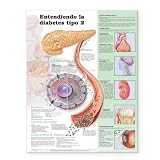 Understanding Type 2 Diabetes Anatomical Chart in Spanish (Comprendiendo la diabetes tipo 2) (Spanish Edition)