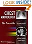 Chest Radiology: The Essentials