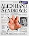 Alien Hand Syndrome: and Other Too-Weird-Not-to-be-True Stories