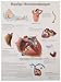 3B Scientific VR0343UU Glossy Paper Haufige Herzerkrankungen Anatomical Chart (Common Cardiac Disorders Anatomical Chart, German), Poster Size 20