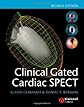 Clinical Gated Cardiac Spect