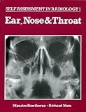 Ear, nose & throat