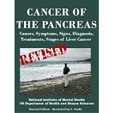 CANCER OF THE PANCREAS: Causes, Symptoms, Signs, Diagnosis, Treatments, Stages of Pancreatic Cancer- Revised Edition - Illustrated by S. Smith