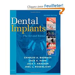 Dental Implants: The Art and Science