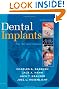 Dental Implants: The Art and Science, 2e