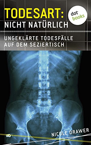 Todesart: Nicht natürlich. Ungeklärte Todesfälle auf dem Seziertisch (German Edition)