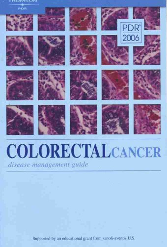 Colorectal-Cancer