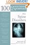 100 Questions  &  Answers About Spine Disorders