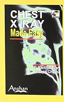 Chest X-rays Made Easy Chest X-rays Made Easy