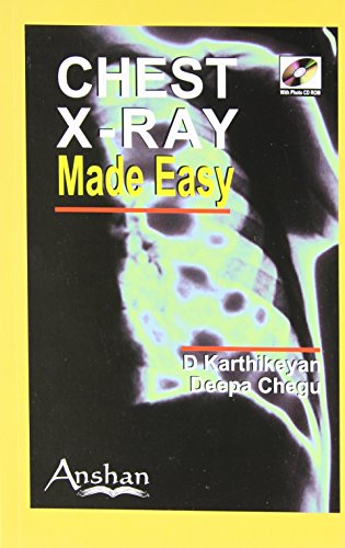 chest x rays made easy