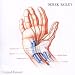 Carpal Tunnel Syndrome