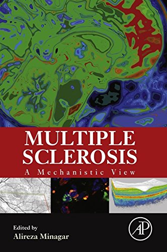 Multiple Sclerosis: A Mechanistic View