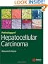 Pathology of Hepatocellular Carcinoma